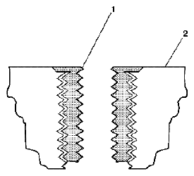 G04841983