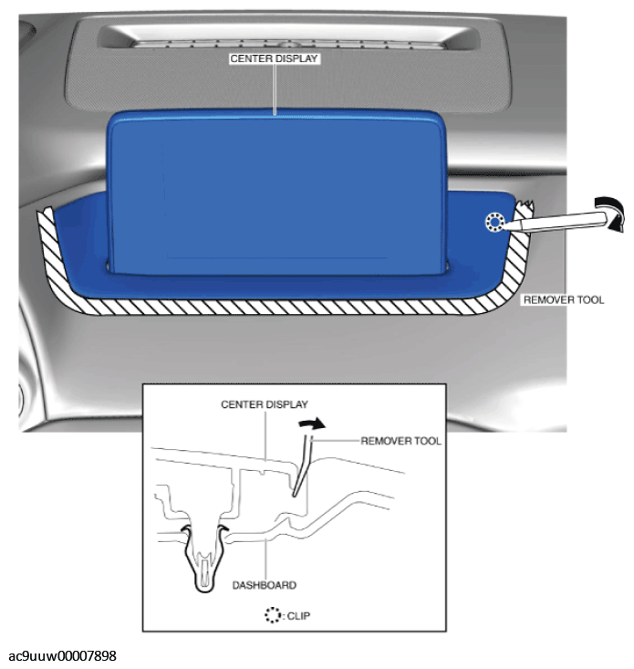 G11430987